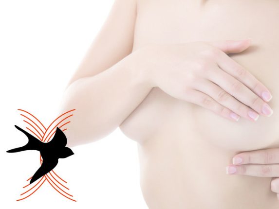 Associazione nazionale donne operate al seno