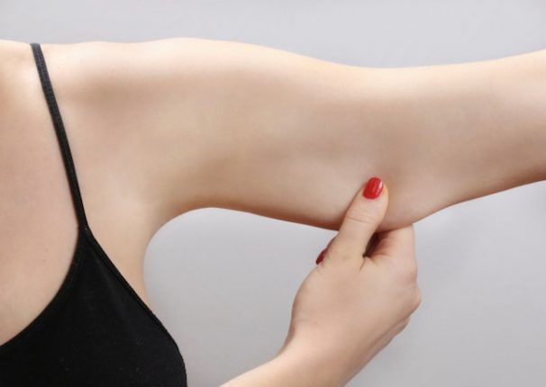 Rimuovere le Bingo Wings: nuovo boom di richieste nella chirurgia estetica