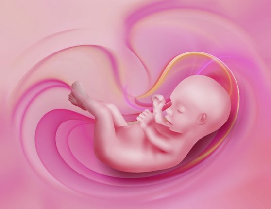 placenta previa