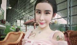 La chirurgia a 15 anni: il caso di Lee Hee Danae