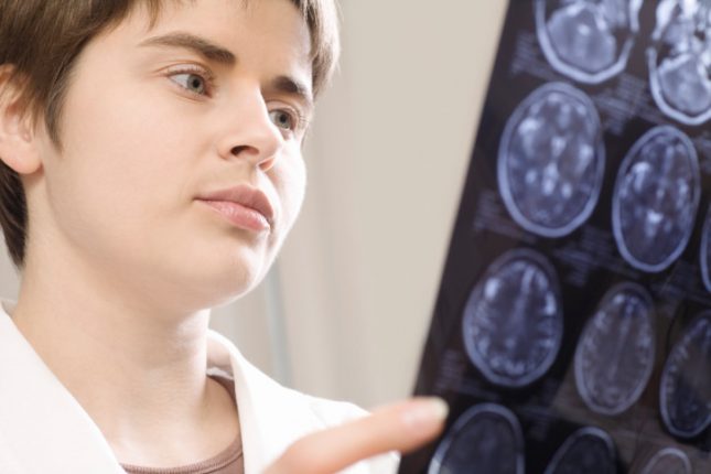 10 cibi che nutrono il cervello: ecco quali scegliere
