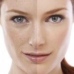 Pelle spenta? 10 prodotti top per renderla più luminosa - crediti foto Garnier