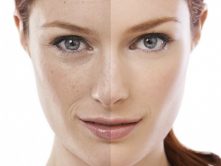 Pelle spenta? 10 prodotti top per renderla più luminosa - crediti foto Garnier