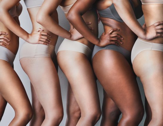 I migliori prodotti del 2016 per combattere le smagliature