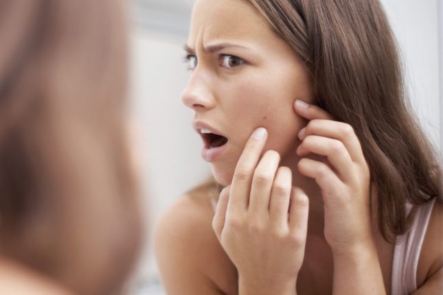 Acne tardiva
