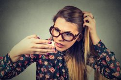 Ragazza con capelli diradati