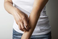 Puntura di tafano: cosa fare
