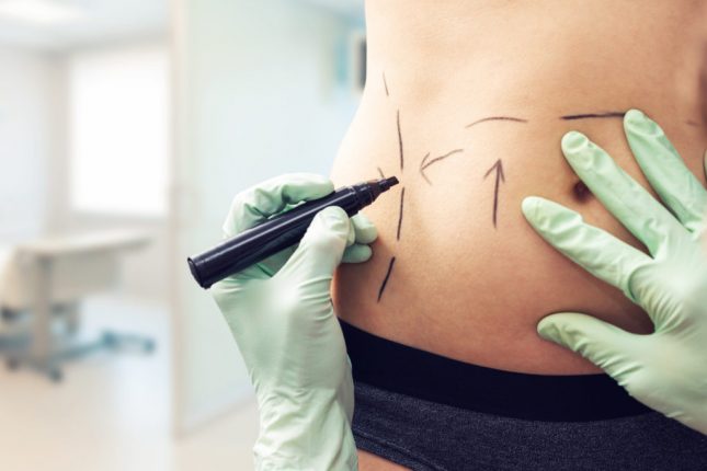 Liposcultura