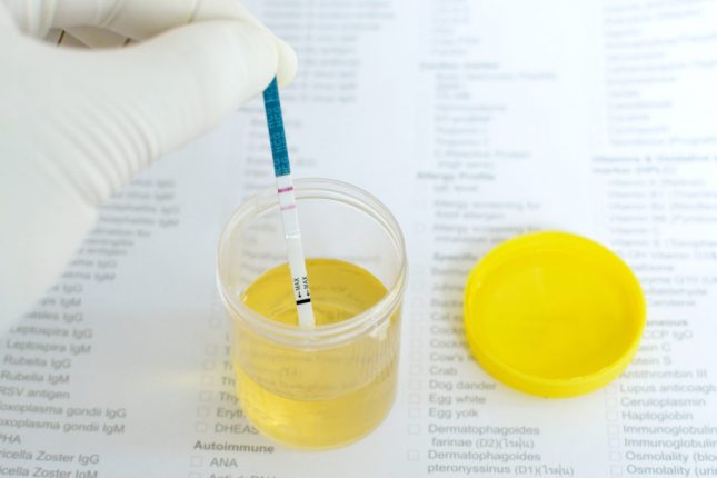 Le analisi delle urine sono le più frequenti in gravidanza