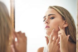 5 regole per combattere l’acne