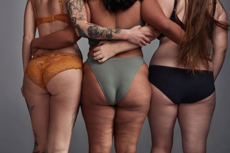 carbossiterapia