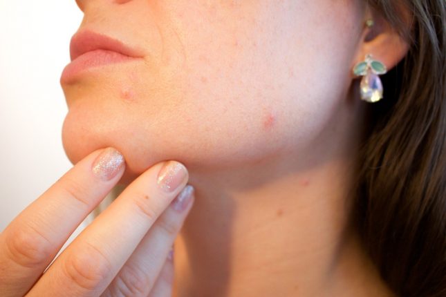 Che cos’è l’acne fungina e come eliminarla