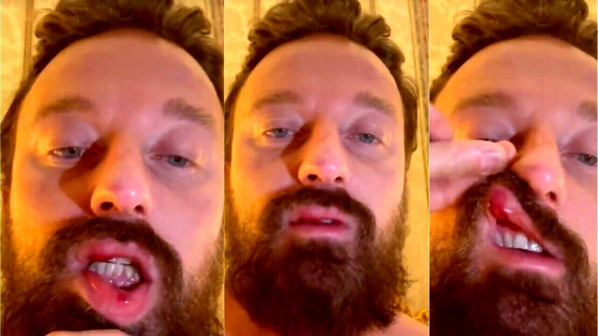 Francesco Facchinetti: novità sull’aggressione di McGregor