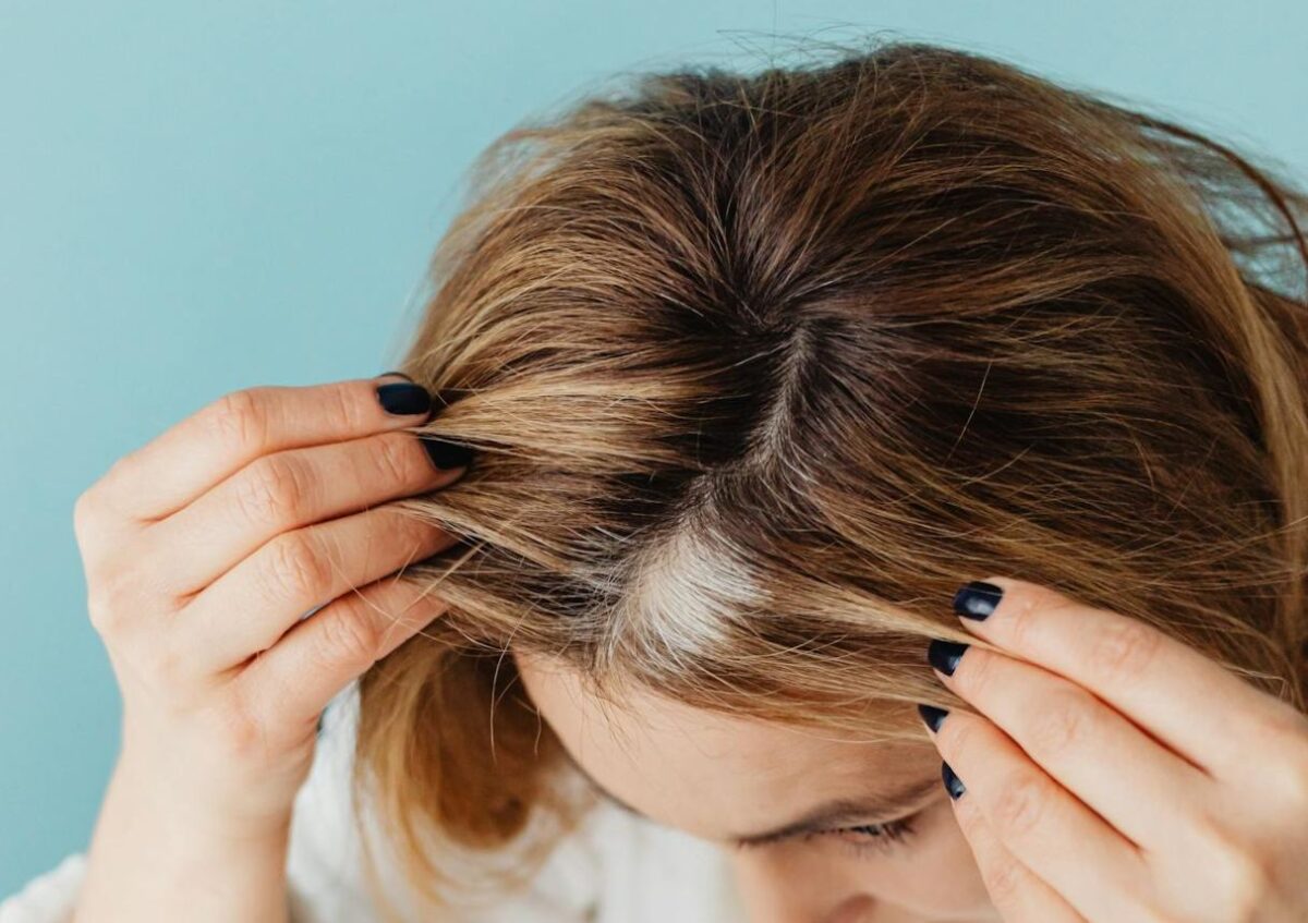 Capelli diradati
